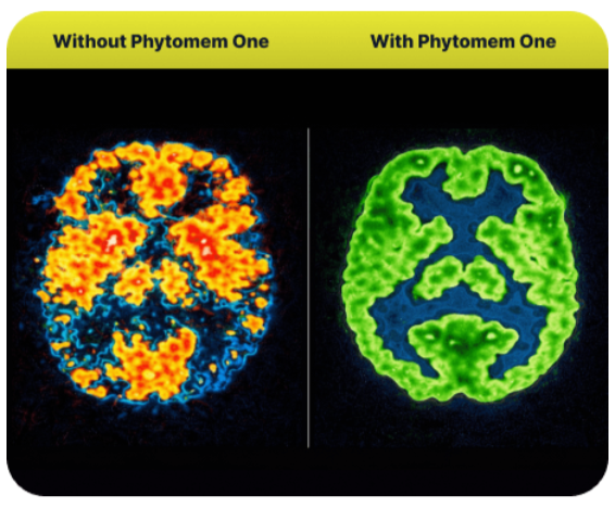 Phytomem One