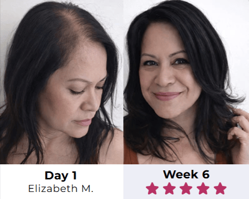 Scalpistry Elizabeth before after