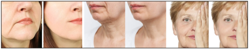 Ageless Anti Aging Cream Benefits